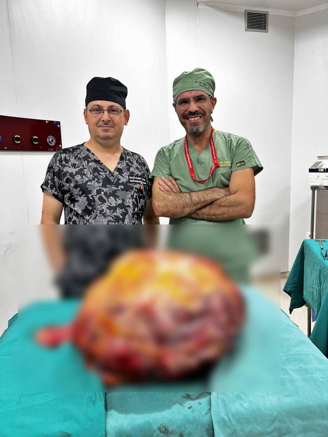 Doktor şaştı kaldı: Bu kadar büyüğünü daha önce görmedim! Hastanın karnından çıkan dev tümör şoke etti 5